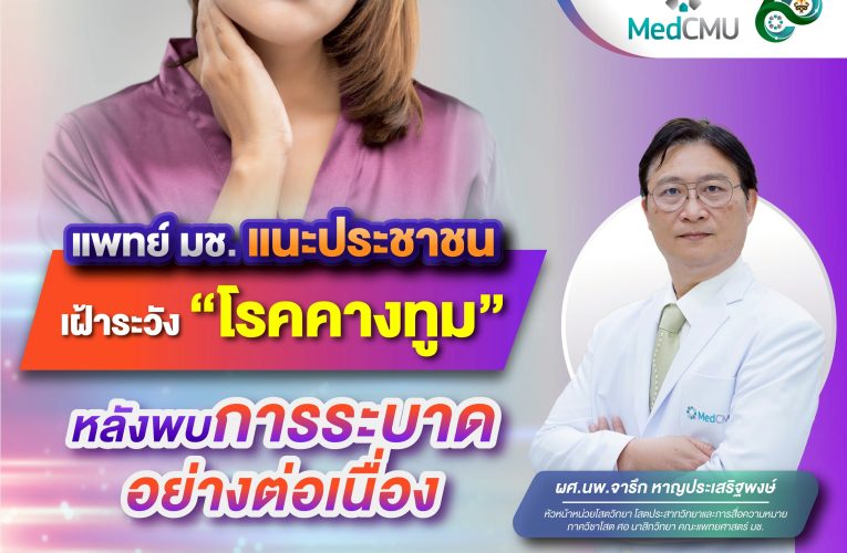 แพทย์มช.เผย พบโรคคางทูมกลับมาระบาดอีกครั้ง ย้ำ!รับวัคซีนครบ สวมหน้ากากอนามัย ป้องกันได้