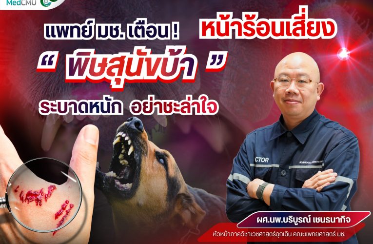 แพทย์ มช. เตือน หน้าร้อนเสี่ยง “พิษสุนัขบ้า” ระบาดหนัก อย่าชะล่าใจ เพราะเพียงถูกกัดหรือข่วนเล็กน้อย อาจร้ายแรงถึงเสียชีวิต 